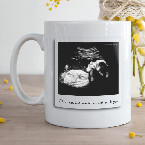 Personalised Baby Scan Photo Upload Durham Mug