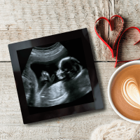 Baby Scan Coaster - Personalised Glass Photo Coaster